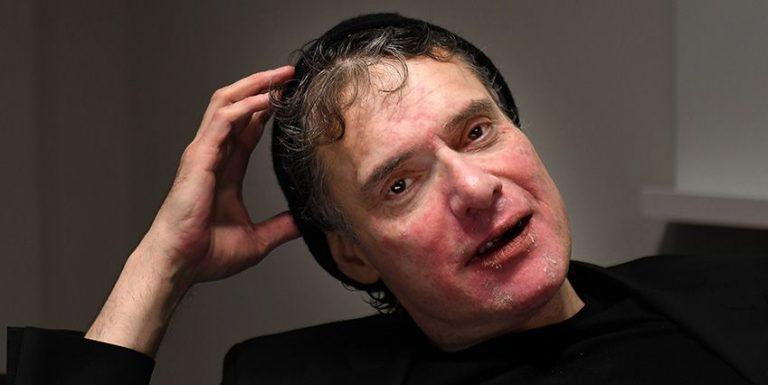 Thorsten Flinck Sjukdom